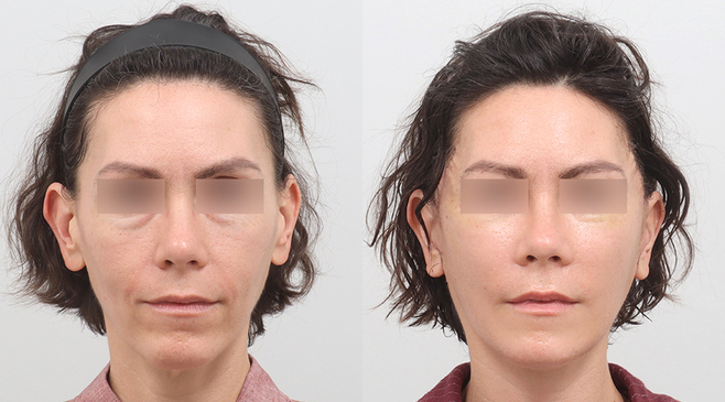 Slider image (6) AB Plastic Surgery